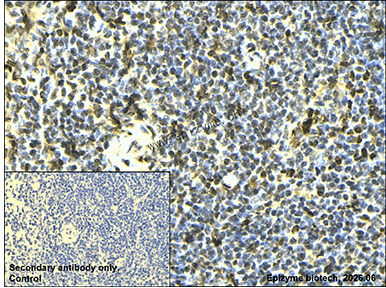 Anti-PSIP1/LEDGF Rabbit mAb [46Q42D76]