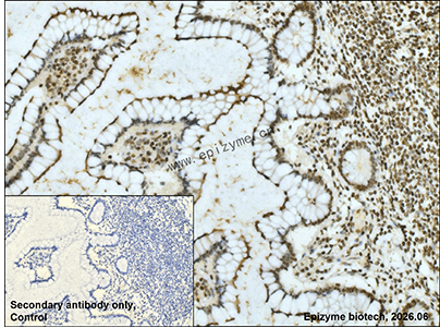Anti-PSIP1/LEDGF Rabbit mAb [46Q42D76]