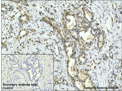Anti-PSIP1/LEDGF Rabbit mAb [46Q42D76]