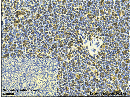Anti-PSIP1/LEDGF Rabbit mAb [46Q42D76]